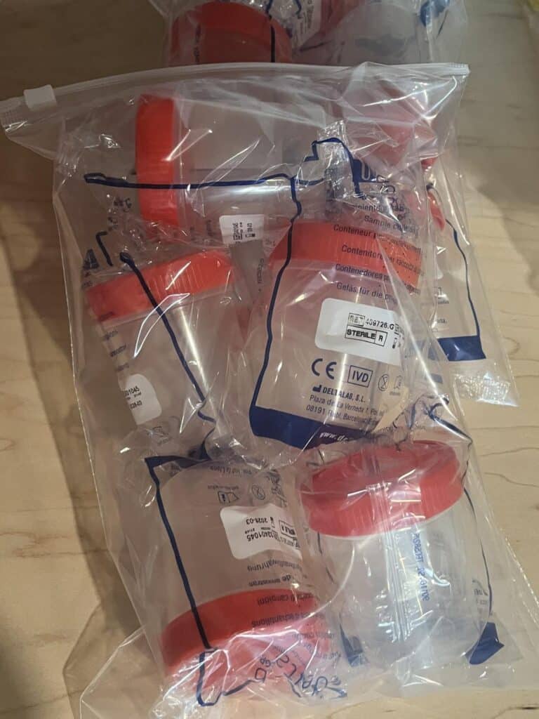 Urine staalpotje steriel 125ml 5st